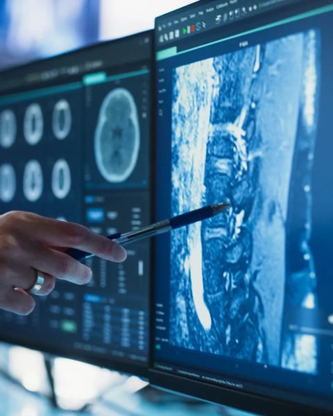 someone pointing at scan with pen