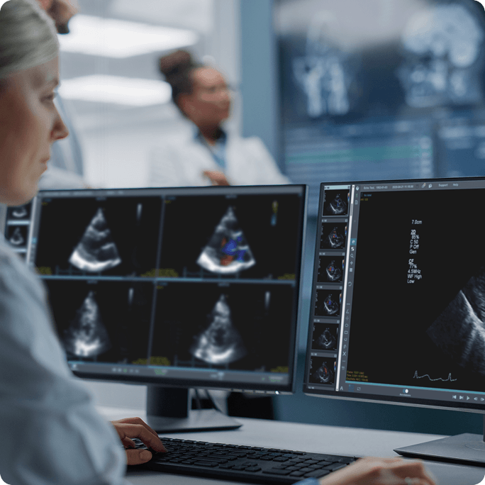 Doctor-looking-at-cardiology-images