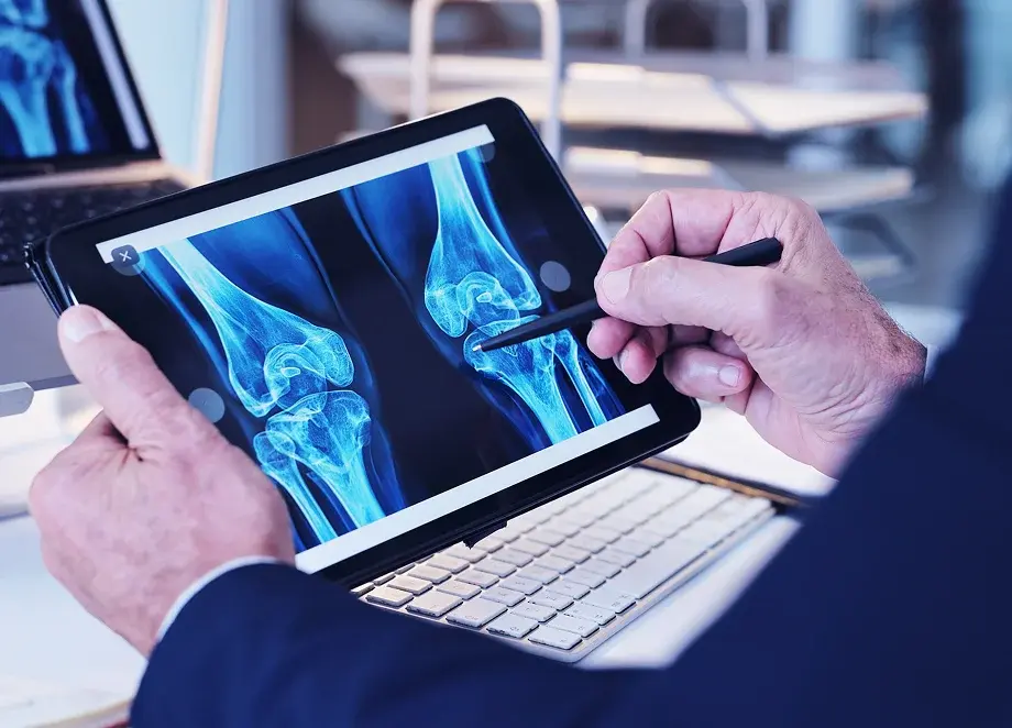person holding tablet with bone scans