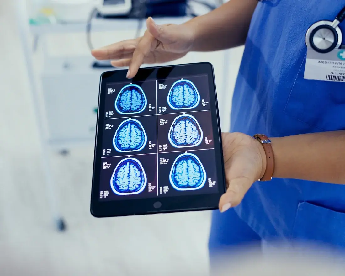 person showing brain scans on tablet